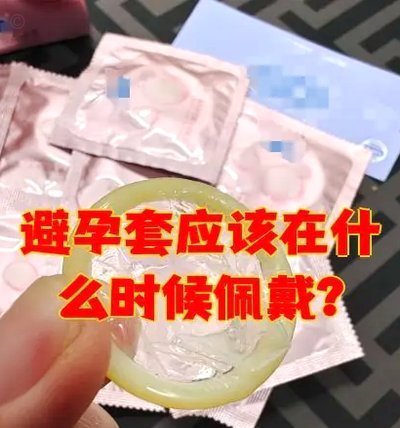 什么是避孕套